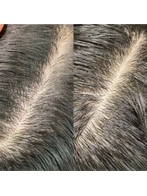 シュール センター南(SURREAL)/ヘッドスパ後のビフォーアフター