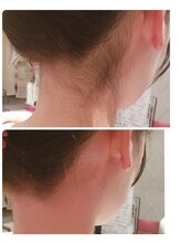 プトゥリ(Putri)/うなじWax脱毛