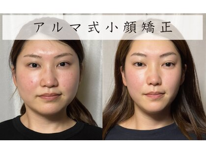 美容整体 アルマの写真