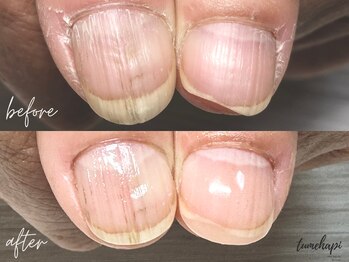 ツメハピ(tumehapi)/しっかり甘皮ケア＋長さ出し