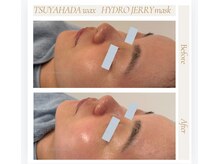 アリー(ALLY)/艶肌wax＋生パック