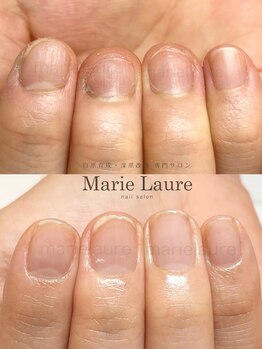 マリーロール 淀屋橋本店(Marie Laure)/自爪育成/深爪矯正/ネイルケア