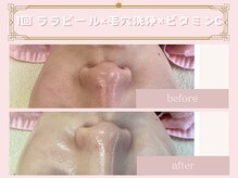 ハンティス(HANTHIS)の雰囲気（大人気のララピール!!高濃度水素水使用はHANTHISだけ!極艶肌に!!）
