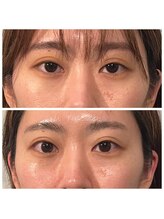 ジャスミン(Jasmine)/目の開き、眼精疲労にも！