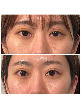 ジャスミン(Jasmine)/目の開き、眼精疲労にも!