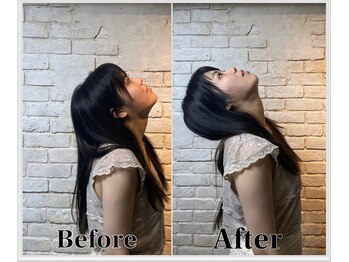 整体ラルース 中目黒(LALUZ)/20代 女性 ストレートネック改善