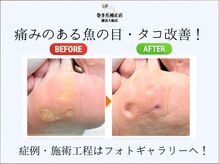 巻き爪補正店 鎌倉大船店の雰囲気（痛みのある魚の目も！★症例・施術工程はフォトギャラリーへ！）