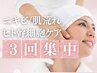 【ニキビ集中肌改善】3回コース/最新美容機器でヒト幹細胞&ビタミンCを導入！