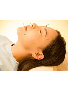 鍼灸施術を受けたい