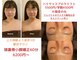 パピヨン(papillon)の写真
