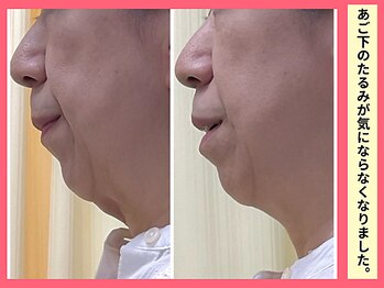 きらり整体院/二重あごが消滅