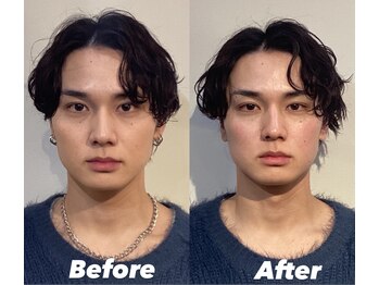 コルミチョン サロン(骨美整 salon)/Before・After