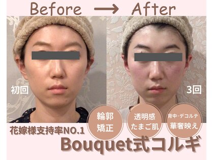 ブーケ(Bouquet)の写真