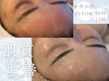 アマテラススキンラウンジ(Amatelas SKIN LOUNGE)