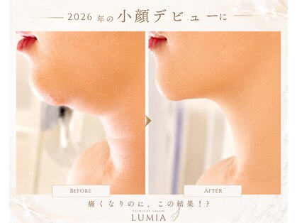 ルミア(LUMIA)の写真