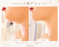ルミア(LUMIA)