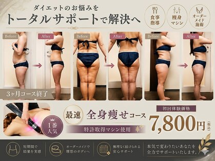 ダイエット サポート(DIET SUPPORT)の写真
