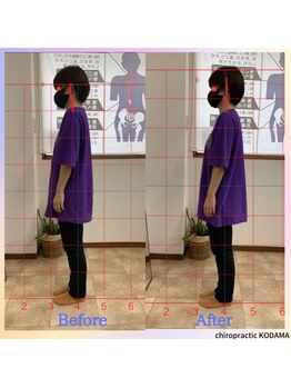 カイロプラクティック コダマ(KODAMA)/姿勢を矯正