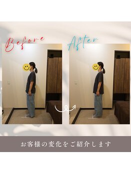 アルク美容整体院(ARUKU美容整体院)/骨盤・首肩スッキリ産後ケア60分