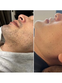 ビューティーサロン マル(Beauty Salon MARU)/