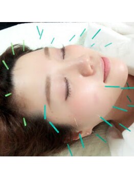 だるま鍼灸整骨院/美容鍼