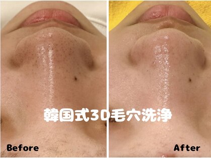 ビーフリー(Be Free)の写真