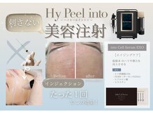 リハーツ(RE;heartz)の雰囲気（【最新美容】栃木県初導入★水光SPフェイシャル★一度でも実感！）