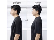 ジェイミープラス 表参道(J‘aimee +)/スマホ首・肩こりの変化