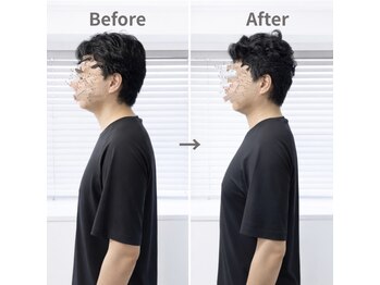 ジェイミープラス 表参道(J‘aimee +)/スマホ首・肩こりの変化