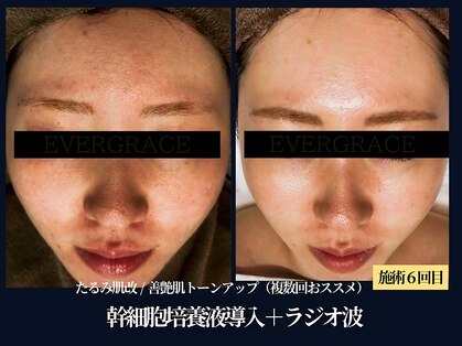 エヴァーグレース 栄店の写真