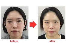 ブプラ 西尾店(BUPURA)/お客様ビフォーアフター(4)