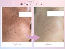 マインドールの雰囲気（シミでお悩みの方に◎泉大津シミケア/フェイシャル/透明感/小顔）