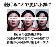 みなと