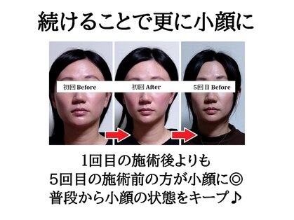 みなとの写真