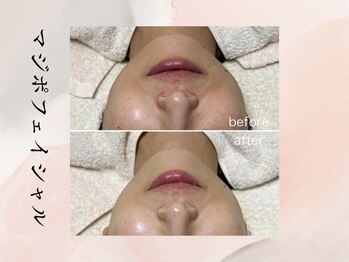 ビシア(Bicia)/マジポフェイシャル