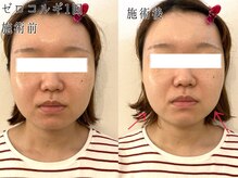 サロン カピリナ(salon Kapilina)/【before→after】