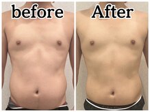 イデアルボーテ/メンズにも人気！