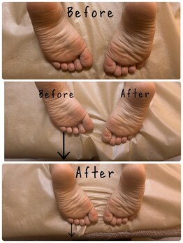 フィール(feel)/Before/After 整体+リンパ