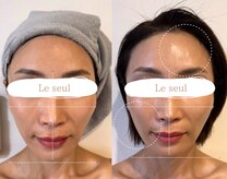 ルソール 銀座(Le seul)