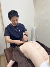 久留米まつもと整骨院 津福院/頭痛眼精疲労専門鍼