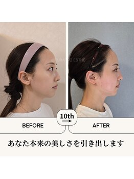 ふらっとエステ/本来の美しさを引き出します