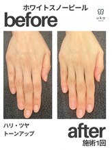 ウカストア ケアアンドシェア NEWoMan高輪(ukastore Care & Share)/ホワイトスノーピール