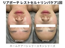リライン(ReLine)/【レストセル＋リンパケア】