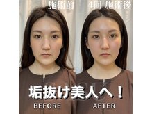 サス(SASU)/凛とし垢抜けならお任せあれ！