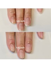 アーティネイルズ(Aaty Nails)/デコボコ爪も綺麗に！