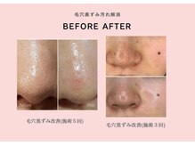 リジュベネーションサロン アリス(Alice)/ララピールB&A