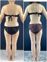 グローアップ(Glow up)/漢方で痩せやすい身体へ導く