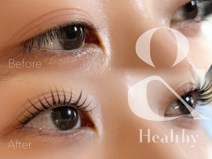 アールラッシュ(R-LASH)の写真