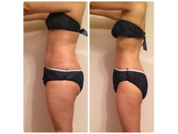 リ オアシス(Re:Oasis)