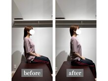 はぴねす鍼灸整骨院 アトレ大森院/【大森】施術変化初回